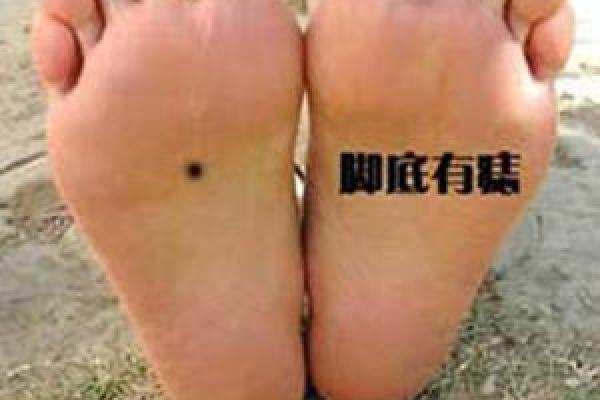 男人脚痣相算命图解