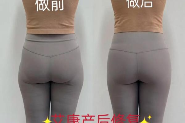 避免八字臀的危害，关爱您的健康