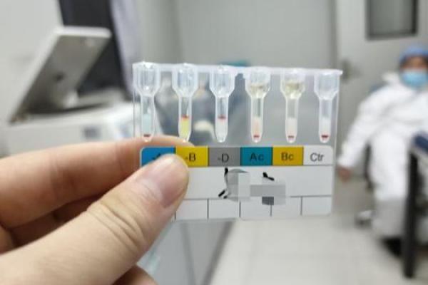 血型可以判断孩子是亲生的吗 血型能鉴定亲子关系吗