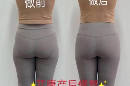 避免八字臀的危害，关爱您的健康