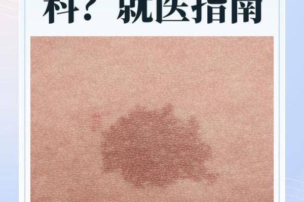 背部胎记算命，背部有胎记会怎样