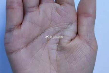 什么是“烦恼线”，手相烦恼线算命图解
