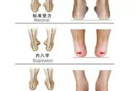 外八字图片