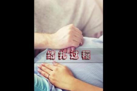 八字结扎
