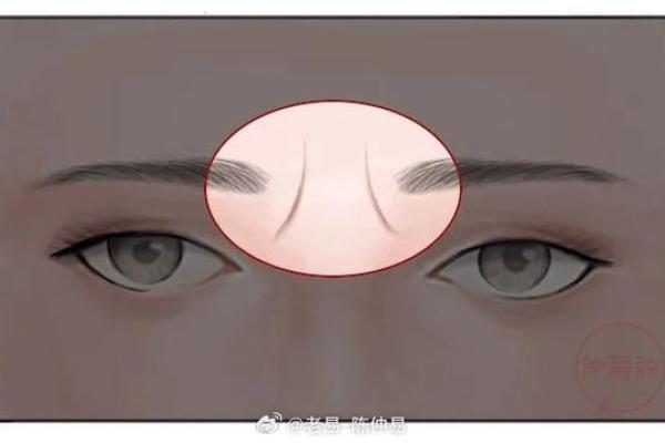 印堂八字纹的男人面相婚姻