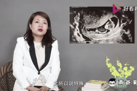 腿上有胎记算命分析