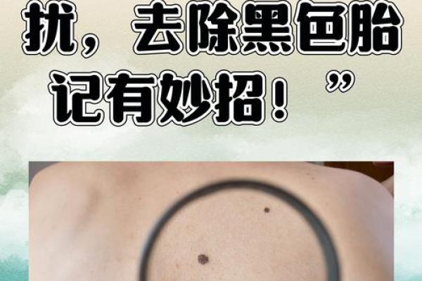 腰部上的胎记如何算命分析？