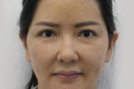 面部衰老八字图